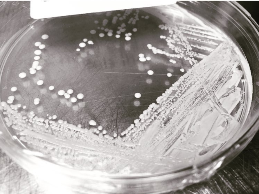 ConEspuma Entendamos el estudio y crecimiento microbiano