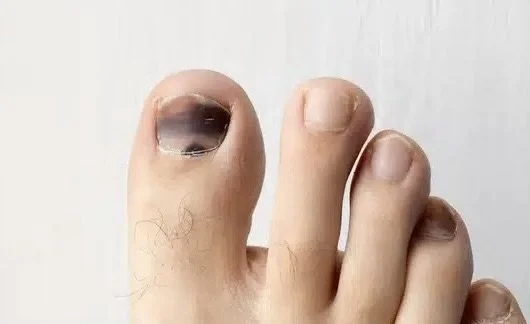 Taking Care of Your Feet on the Camino