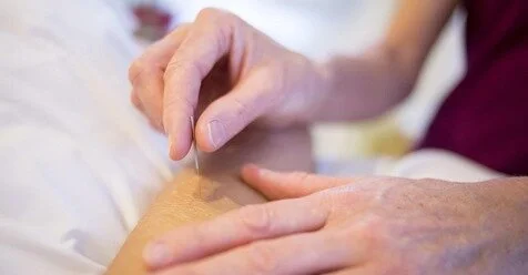 Dr. Tom Shares His Insight About "How Acupuncture Can Help You Sleep" by Jennifer Walker-Journey