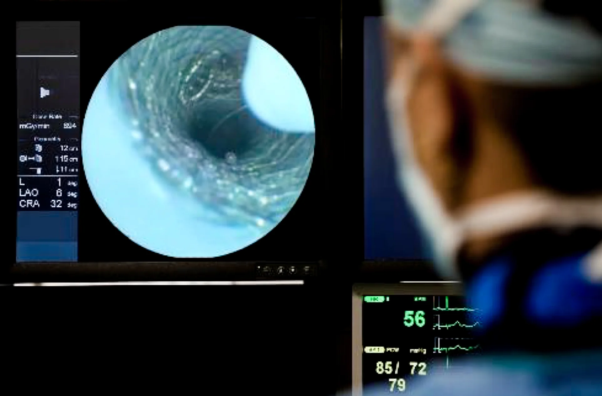 SFE Image provided by Patrick McVeigh MD, University of Toronto, Canada