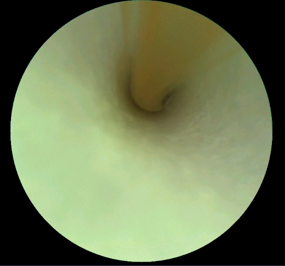 Live Rabbit In Vivo Video with Scanning Fiber Endoscope