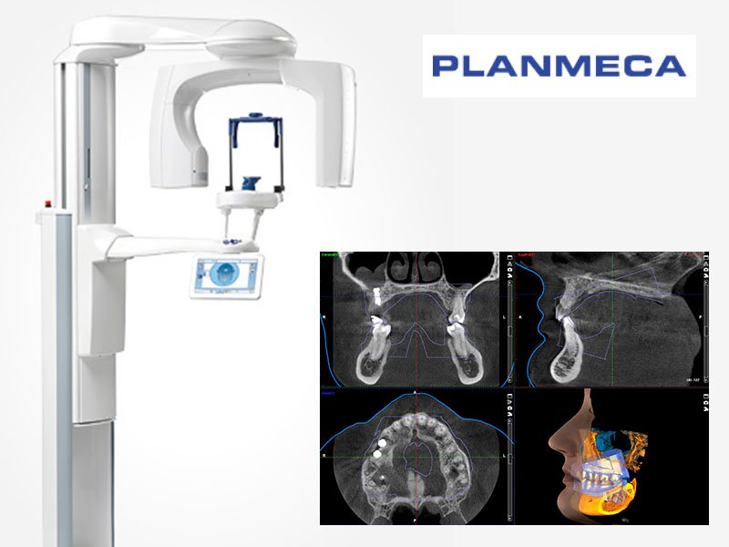 Planmeca-3D-CT-Scan.jpg