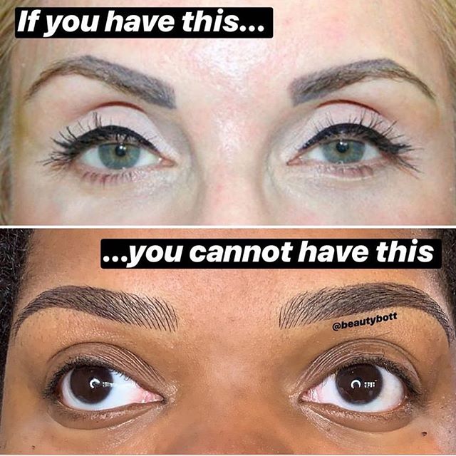 If the top photo is you...
.
OPTIONS: 1️⃣ Use retinol and/or exfoliate daily on eyebrow area. This should gradually help it fade very slowly 2️⃣ Find a qualified technician to do removal treatment via salt &amp; saline (will take 1-4 sessions 8 weeks
