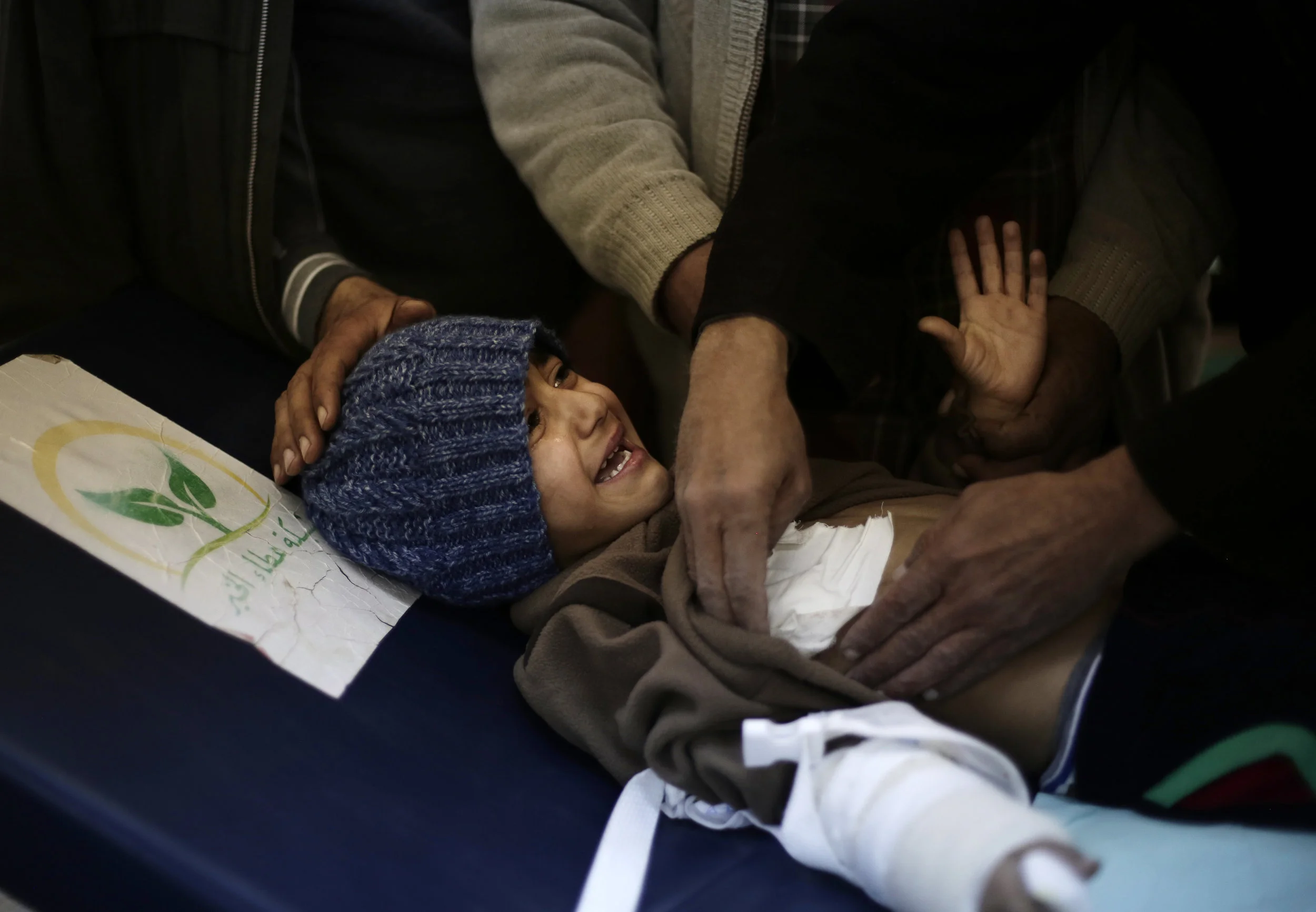 A boy injured by an Islamic State militant drone is checked by a doctor in Mosul on Feb. 14, 2017. His brother died in the attack. 