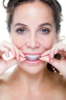 woman putting a retainer in for invisalign