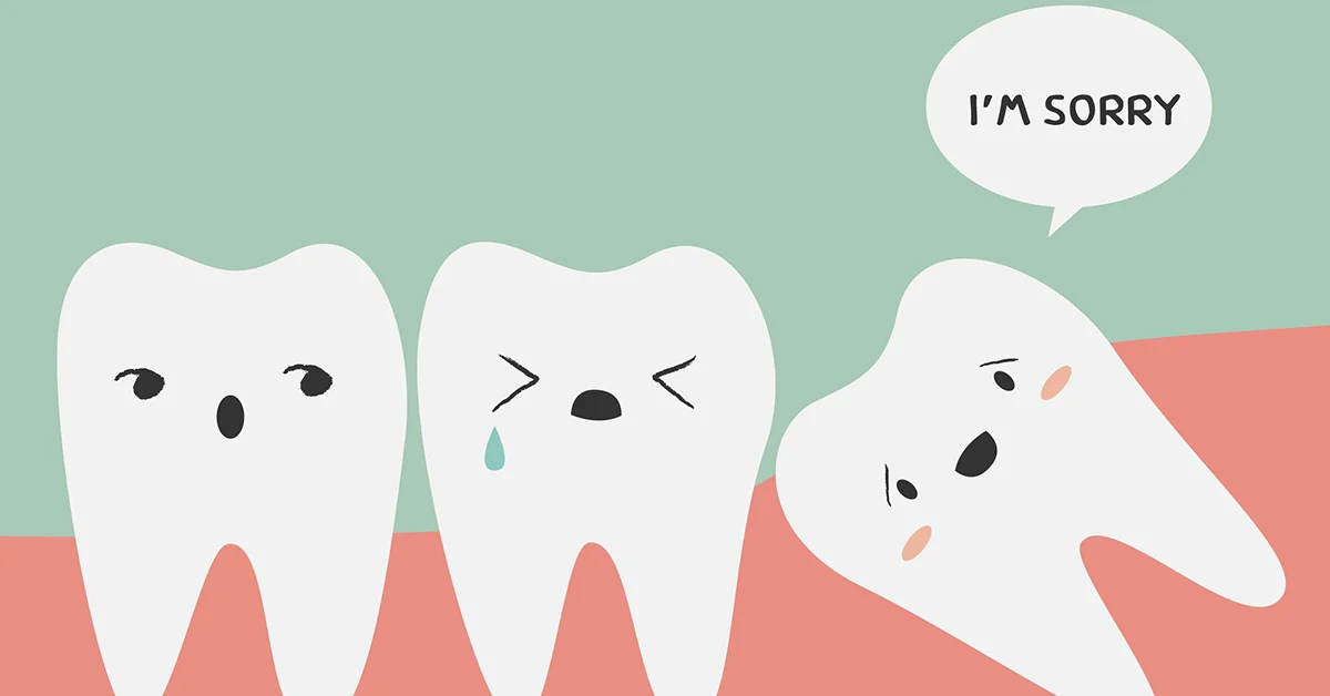 About wisdom teeth