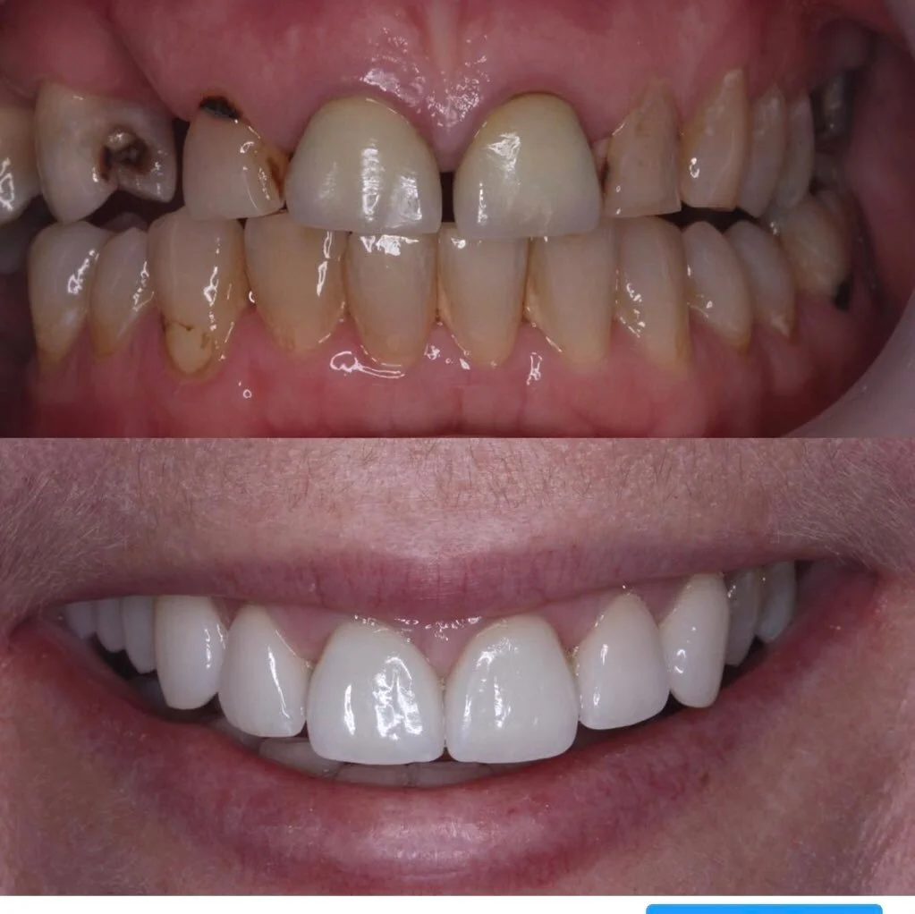 Brisbane Smile Boutique Brisbane Dentist for Aesthetic Dentistry