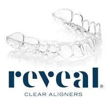 Reveal Clear Aligners.jpeg