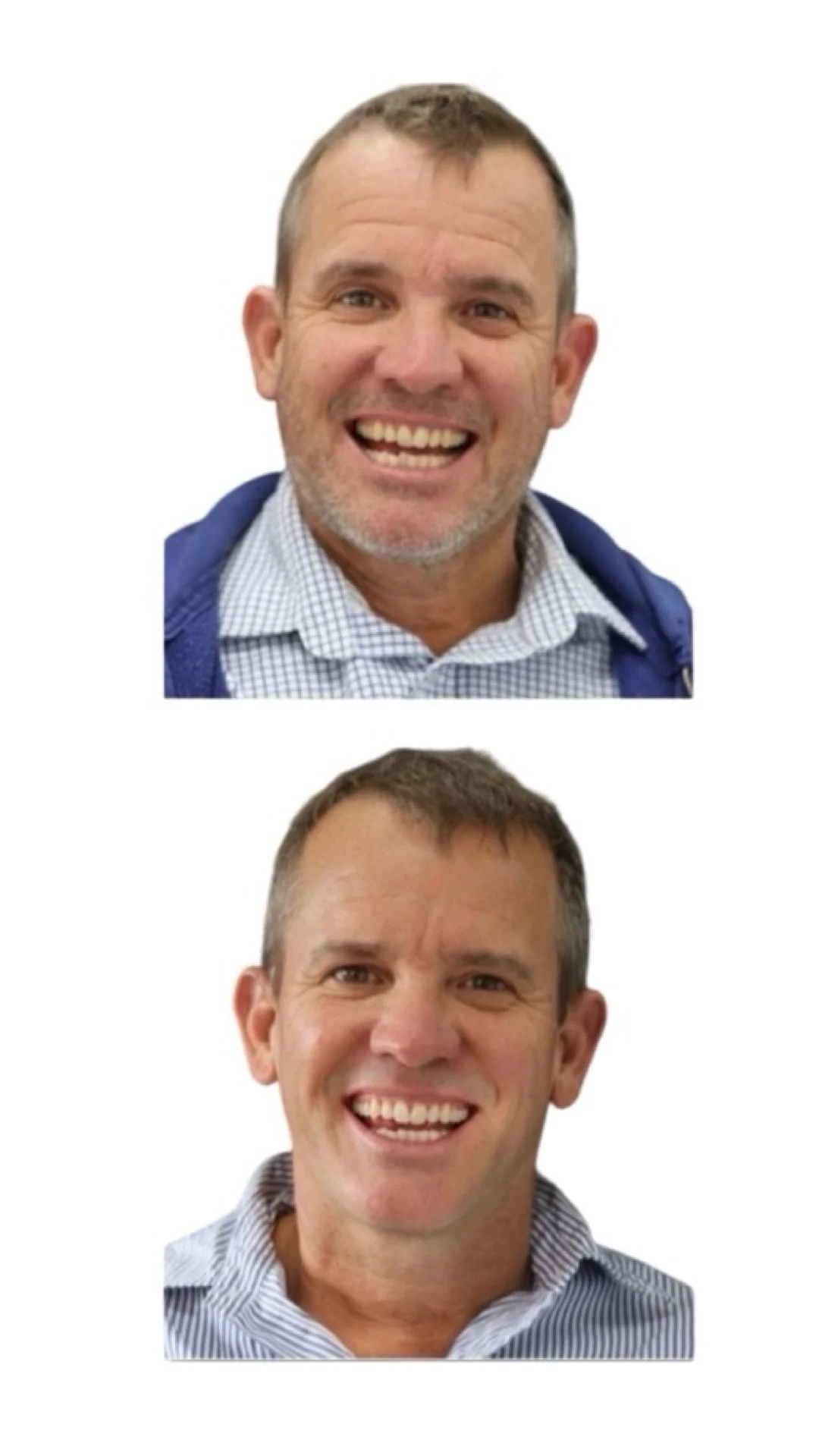 before and after image of a middle aged man who has had Invisalign dentist Brisbane clear aligner treatment at Brisbane Smile Boutique, with Dr Leila Haywood, one of Brisbane's finest female cosmetic dentists