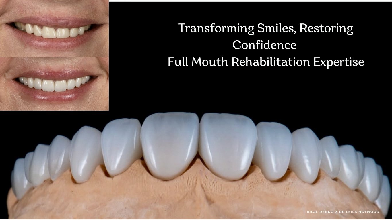 Cosmetic dentistry graphic showing veneers close-up and improved smile, highlighting full mouth rehabilitation expertise.
