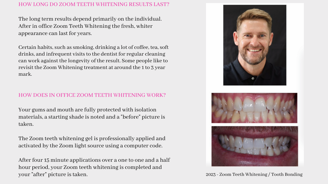 Zoom Teeth Whitening Brisbane Cosmetic Dentist Brisbane Smile