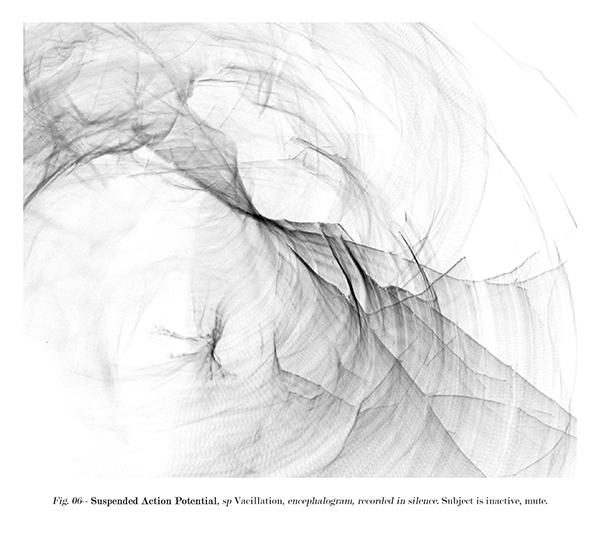 archival pigment print, Encephalograms series, 2005