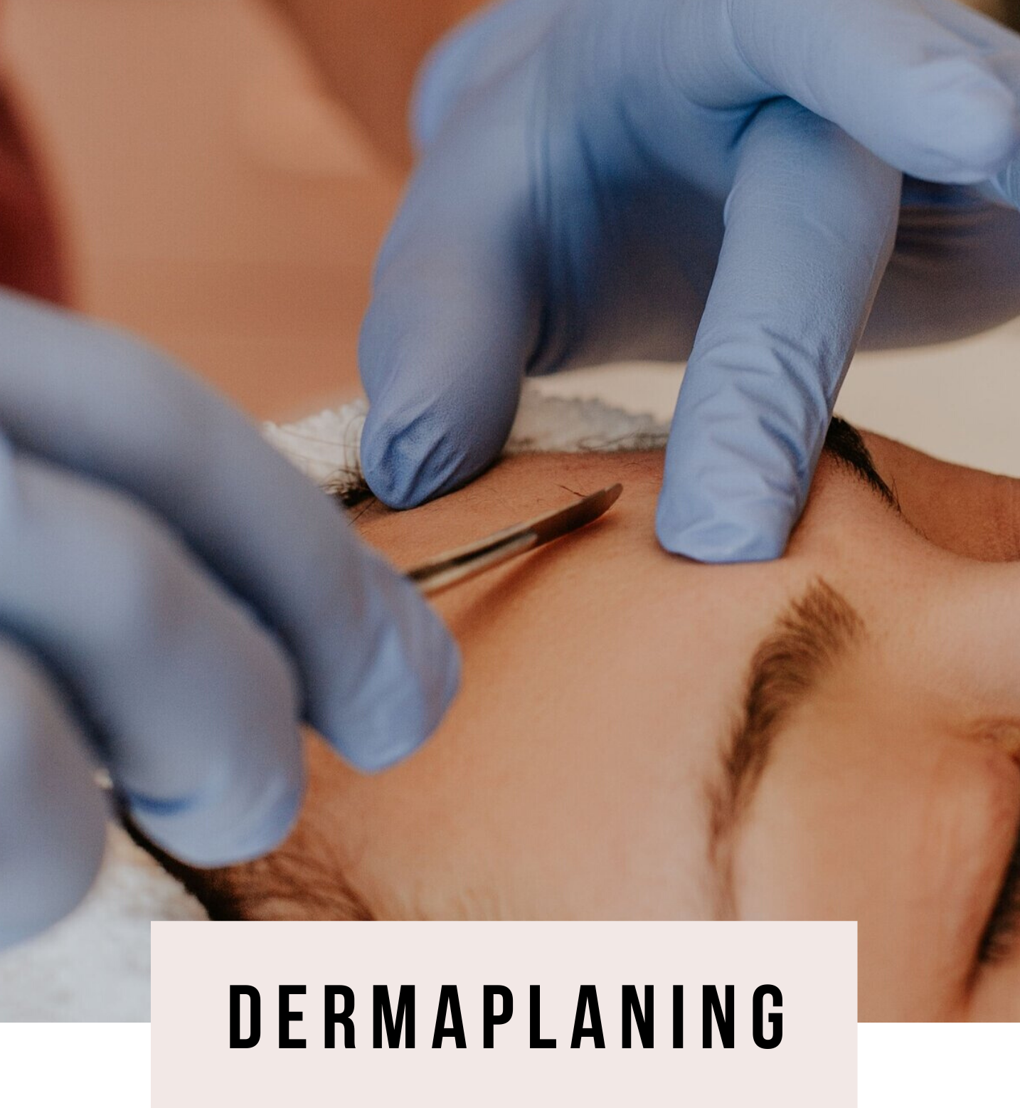 dermaplaning near me