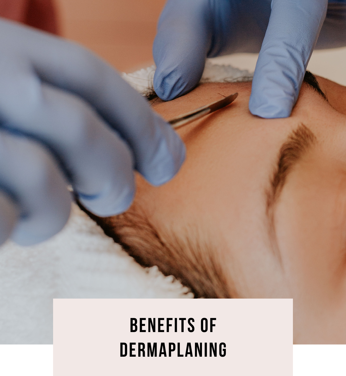 Benefits of Dermaplaning