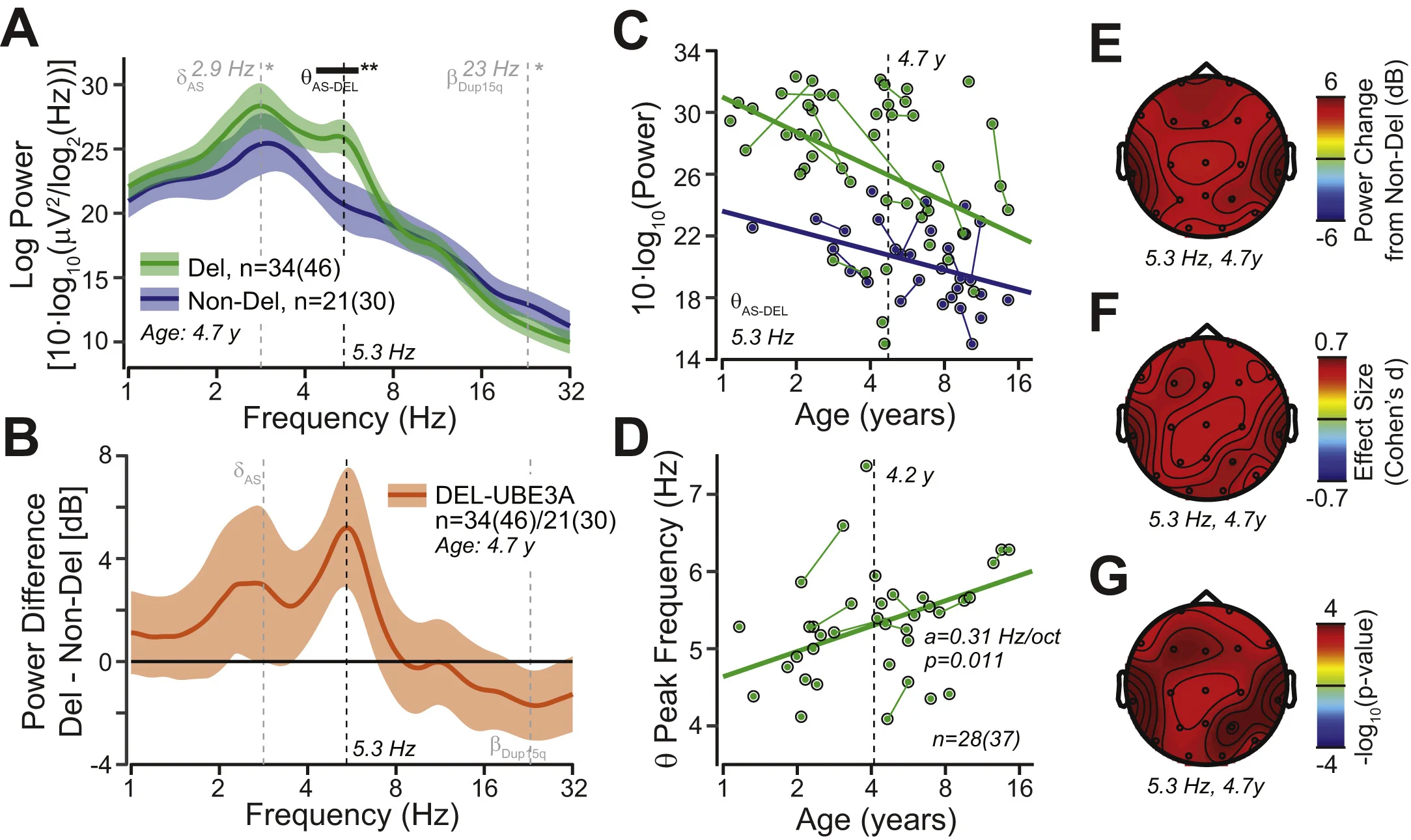 Figure 5, Frohlich et al., 2019 . Spectral power differs between Angelman syndrome (AS) genotypes . (A) Grand average power spectral density derived from the linear mixed model with age set to the mean log2 age of 4.7 years (average across all visits and electrodes). Deletion AS (Del) is shown in green, nondeletion AS (Non-Del) is shown in blue. The colored bands show 95% confidence intervals. The black bar indicates frequency ranges with significant group differences (corrected for multiple testing across frequencies). The gray lines indicate the specific hypotheses tested in the delta and beta bands (see Figures 3 and 4 ). (B) Difference in spectral power between deletion AS and nondeletion AS. The colored bands show 95% confidence intervals. (C) Developmental trajectory of theta power (5.3 Hz) derived from the linear mixed model (average across all electrodes). Longitudinal visits are connected by solid lines. (D) Correlation between theta peak frequency and age. Longitudinal visits are connected by solid lines. (E–G) Scalp topography of power change in decibels, effect size (Cohen’s d ), and p values for t tests between deletion AS and nondeletion AS derived from the linear mixed model for 5.3 Hz and the mean log2 age of 4.7 years.