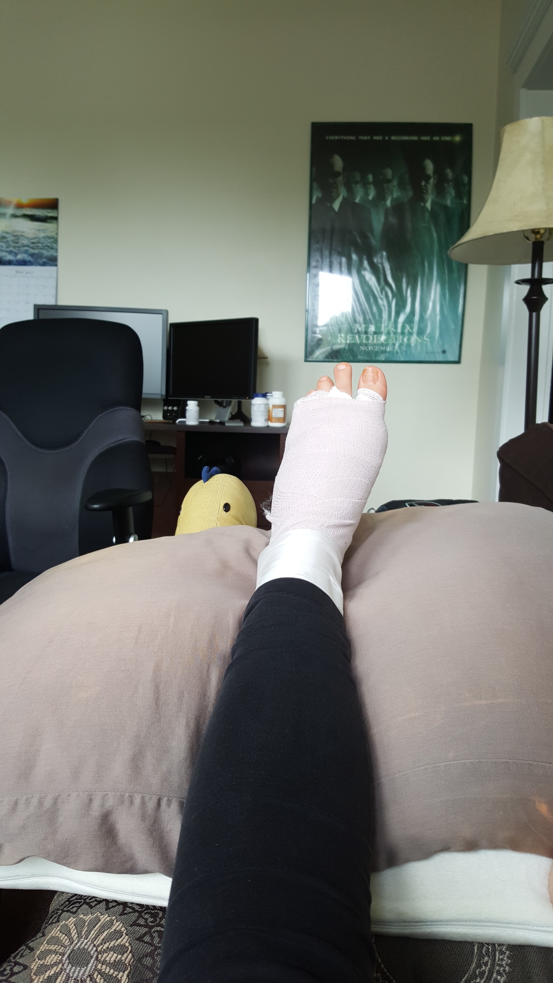 My foot post-surgery, with a creeping dinosaur keeping an eye on me