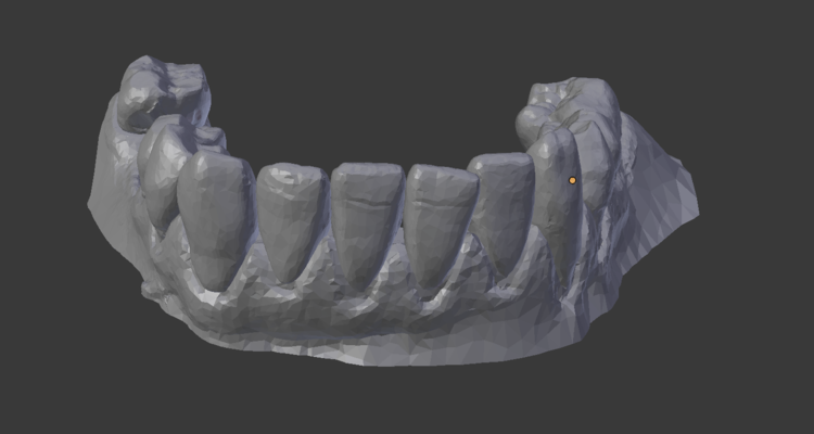 Teeth bottom: start