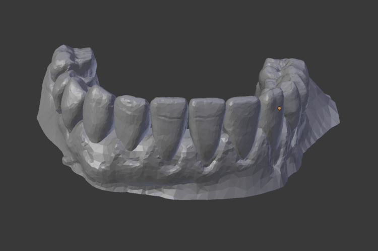 Teeth bottom: finish