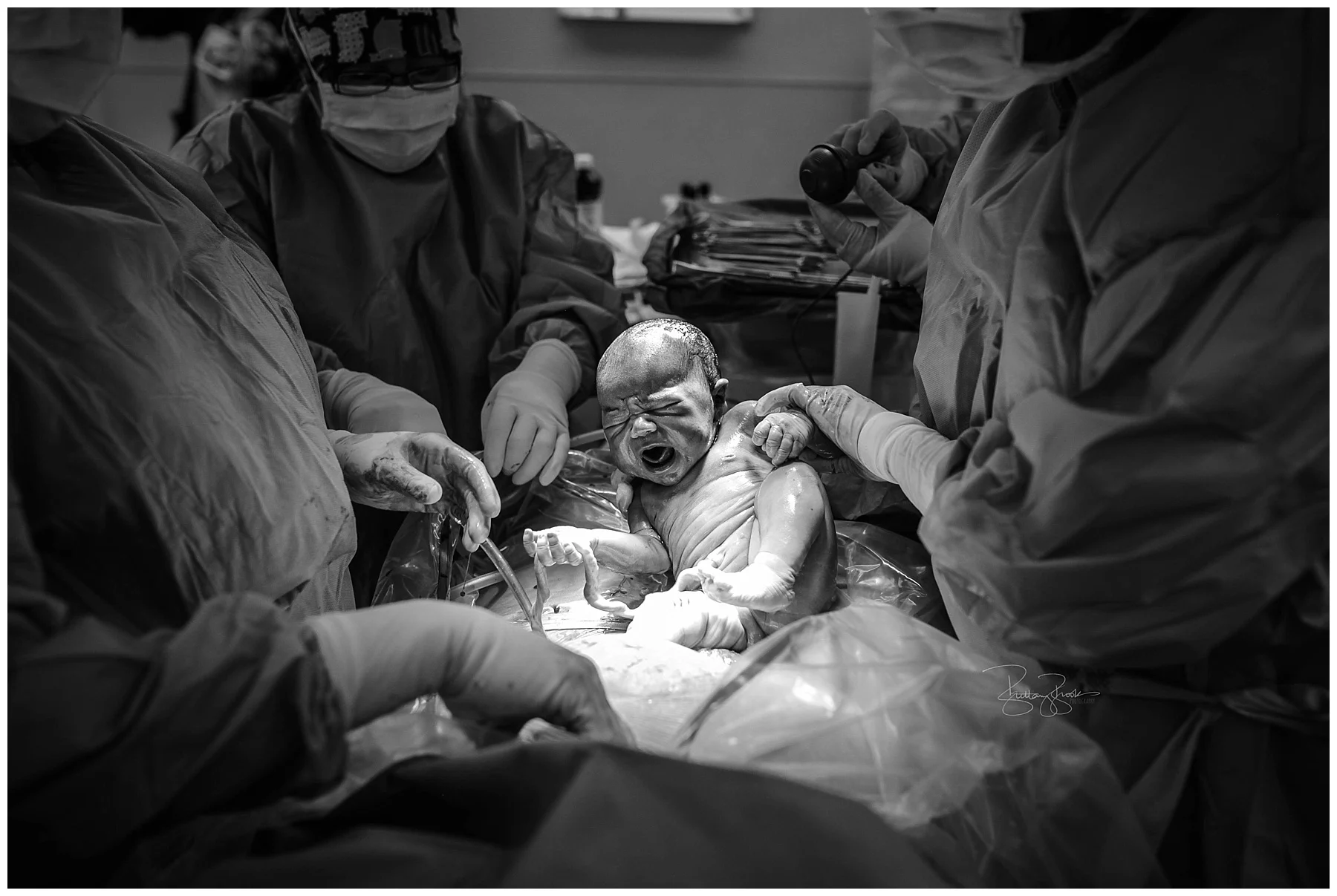 This is from the very first cesarean I ever attended. Baby girl was hanging onto her cord here and started waving it around.