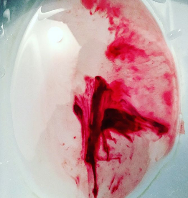 Ruckedigu, Blut ist im Klo - Foto: Ara Dn. Eden Instgram: ruckediguu.pure.art