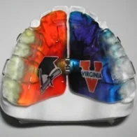 The Swartz Expander is made of acrylic and metal and fits in the roof of your mouth. Its purpose is to increase the width of the upper jaw, which is accomplished by turning the screw in the center of the appliance. This is done for a period of time as directed by the doctor. It is removable, and fully customizable by both color and design.