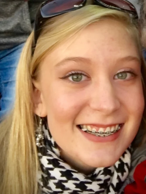 A Griffin & Errera client matched her braces to her favorite football team. During each appointment, bands can be customized with two of 25 different colors.