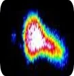 Cavitation Image.jpg
