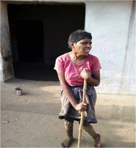 Sarojini, a Kanwar Adivasi, cannot get her disability pension anymore because of errors in Aadhaar linking. An amount of Rs 4,550 has been denied to her in Aadhaar errors.