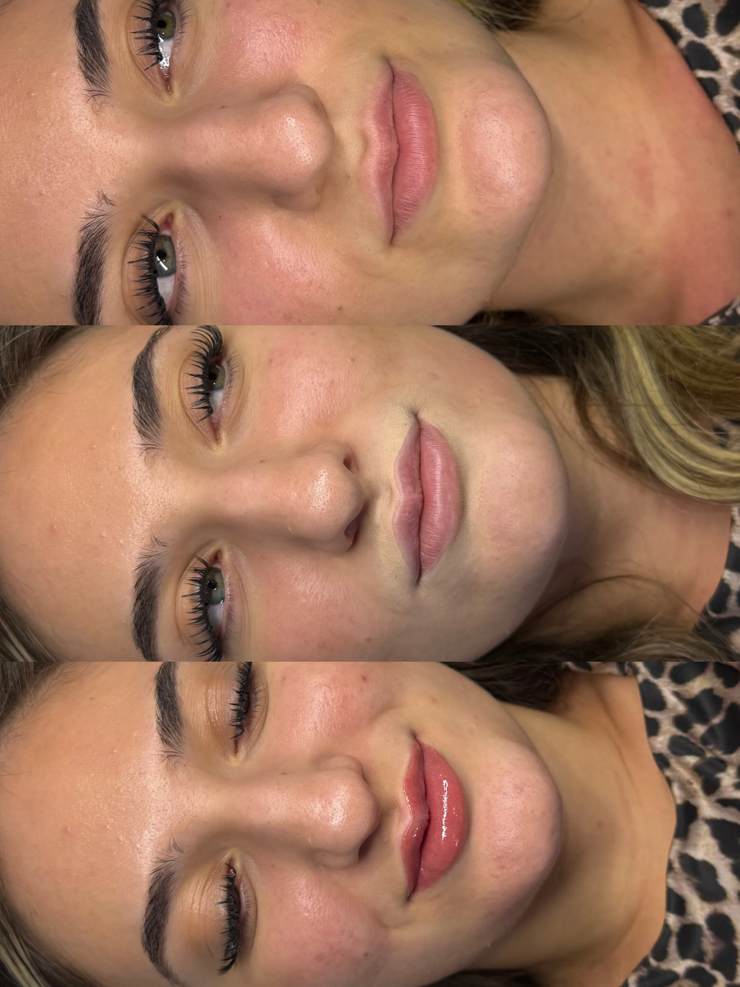 Natural Lip Blush Before &amp; After