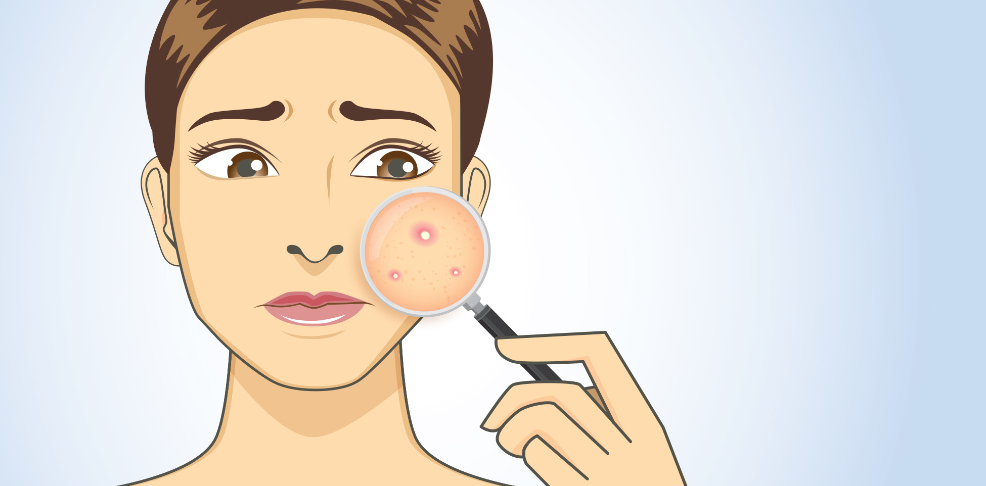 Skin Problems Every Woman Goes Through and How to Treat Them
