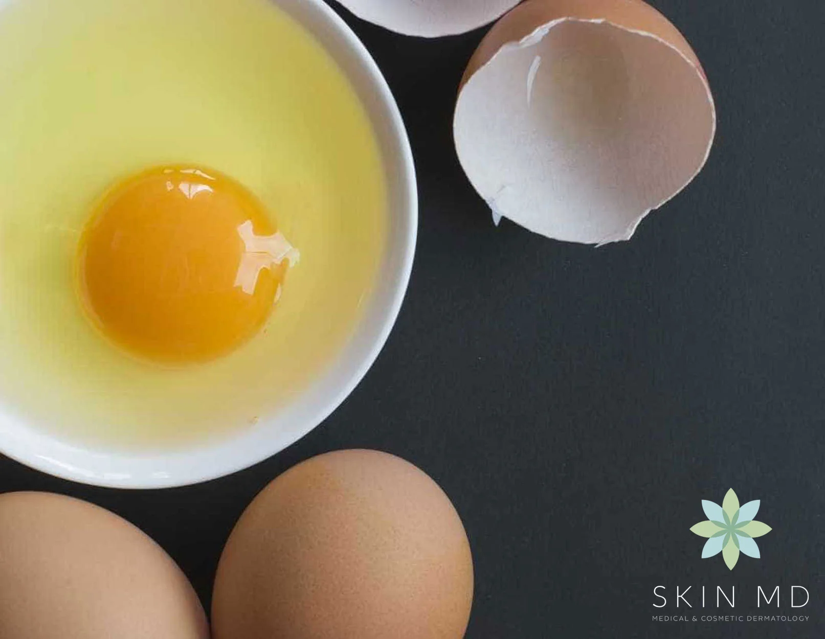 Eggs.jpg