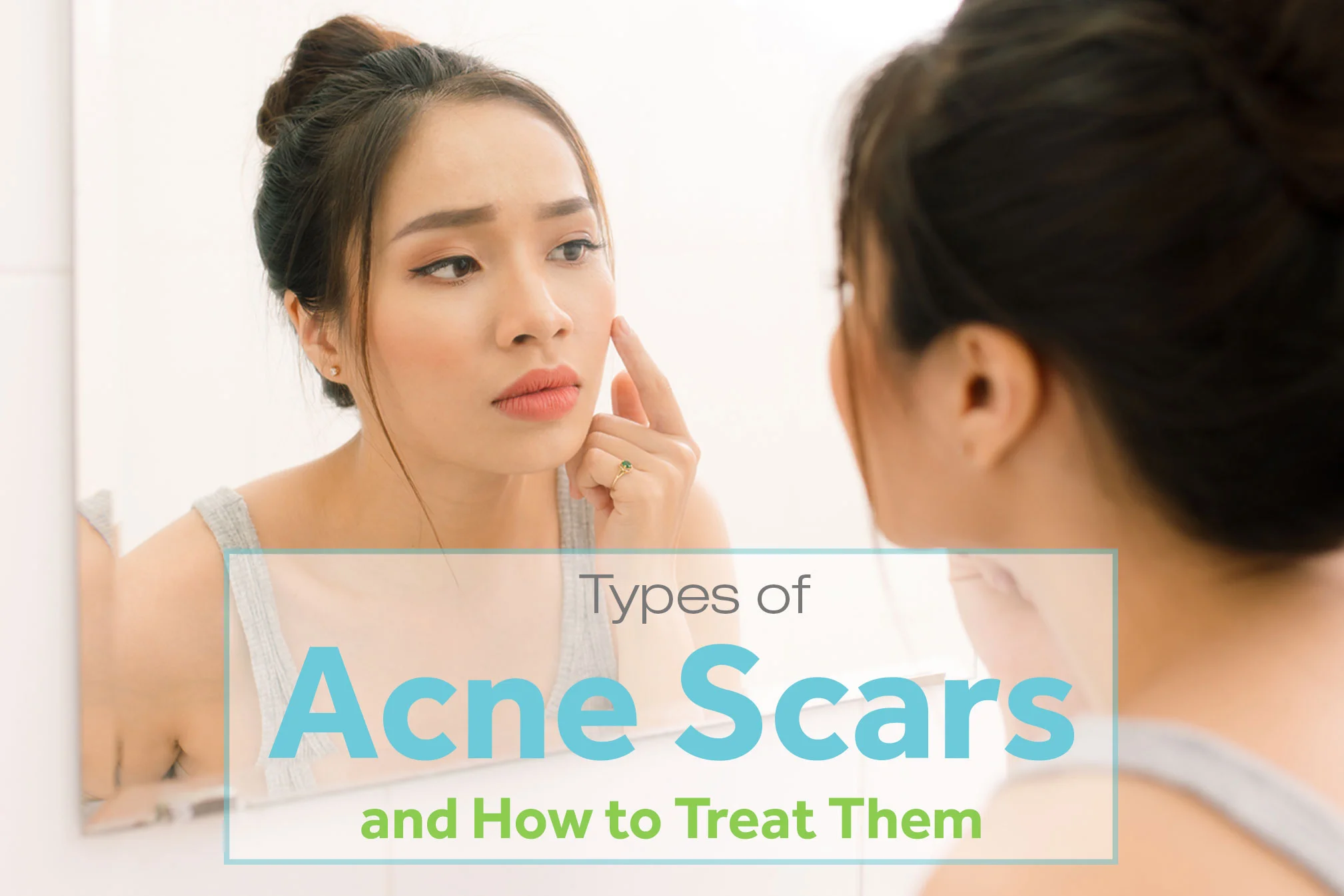 Types of Acne Scars and How to Treat Them