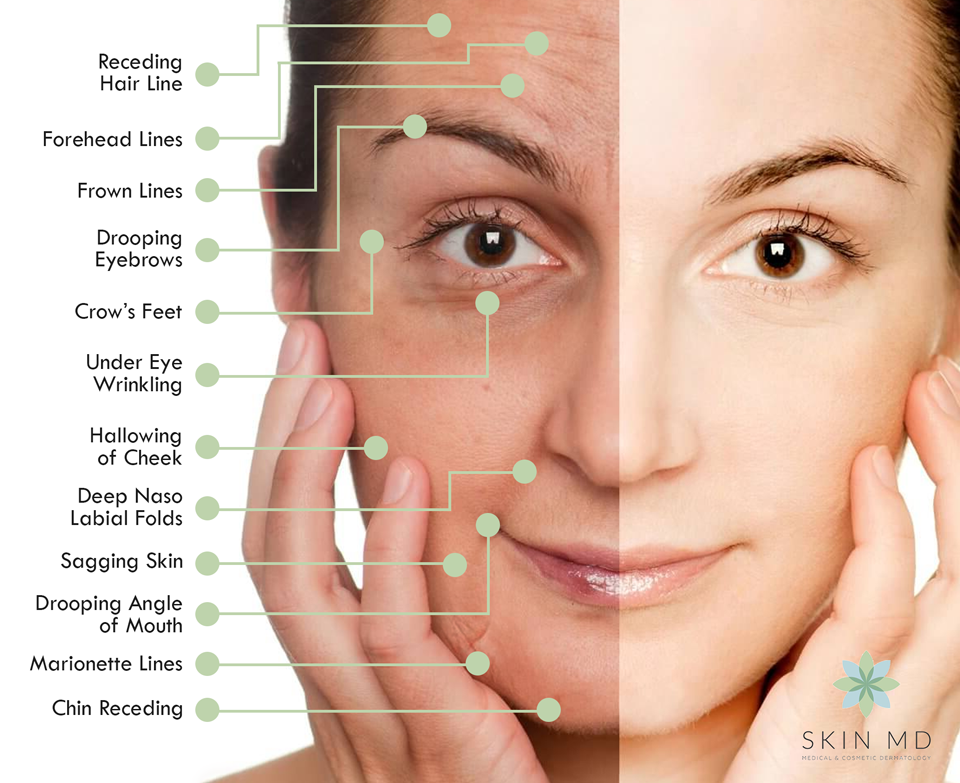 The Anatomy Of An Aging Face — Skin Md Dermatologist In Ortigas Pasig