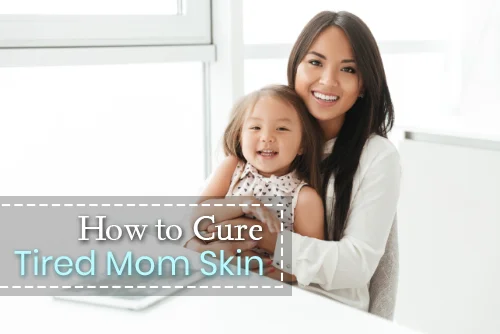 How to Cure Tired Mom Skin