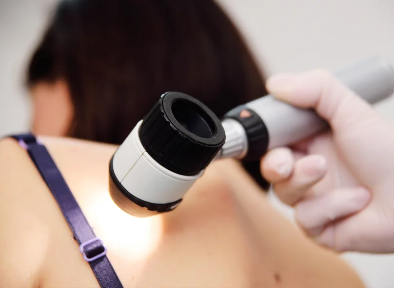 the-types-skin-cancer1.jpg