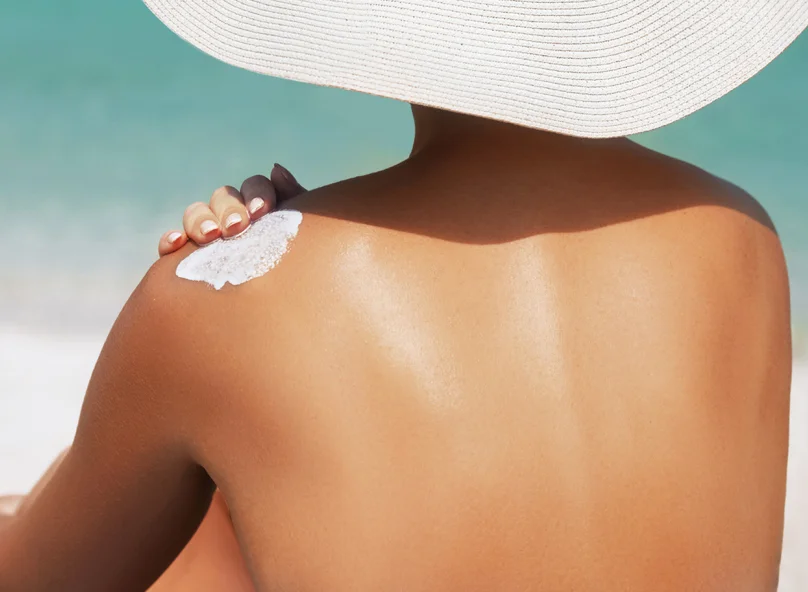 can-do-sun-damage.jpg