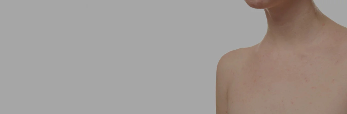 sun-spots-header.jpg