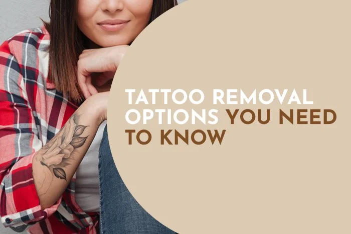 Tattoo Removal Options You Need to Know