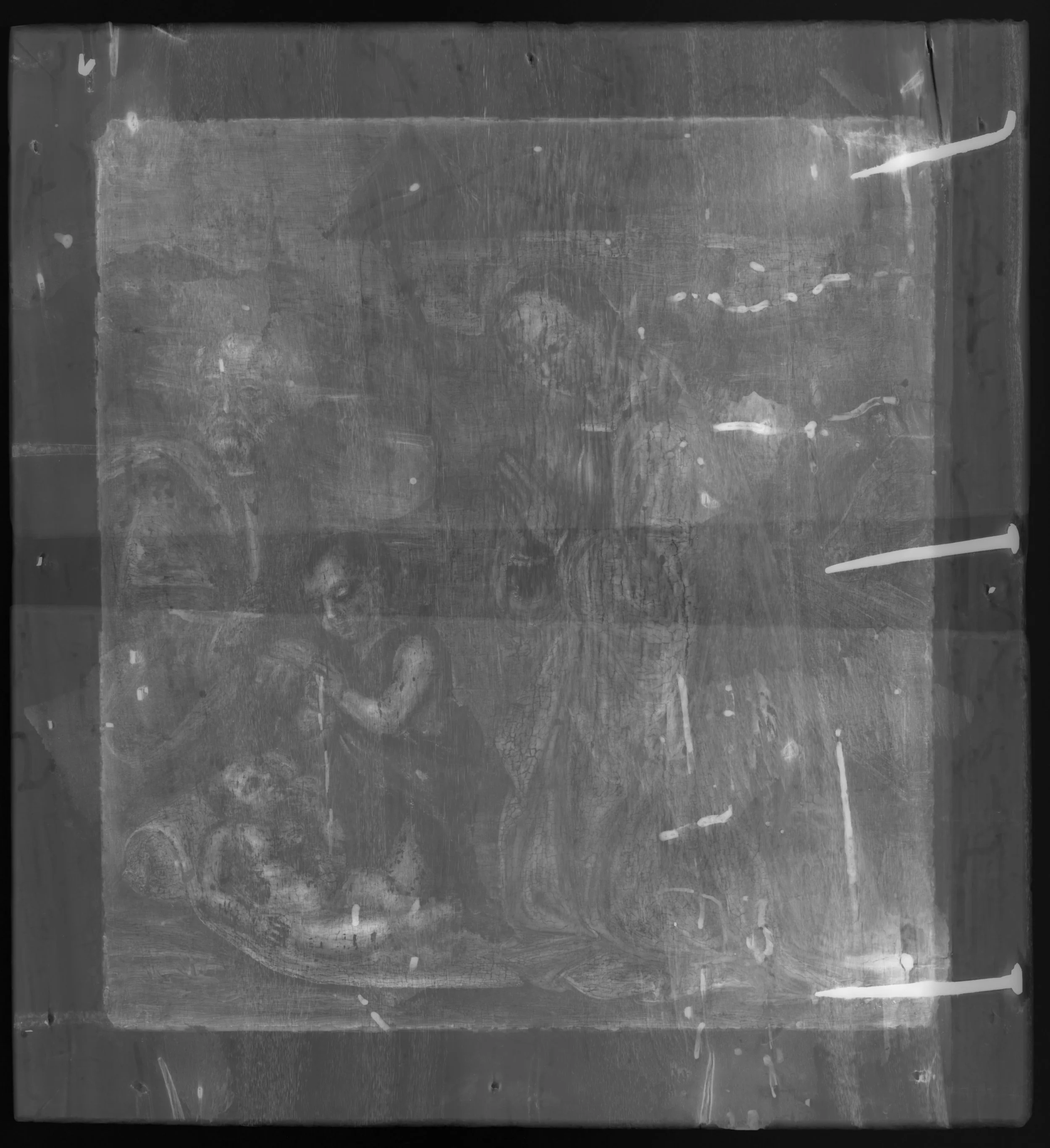 Black and white X-radiograph of the present work.