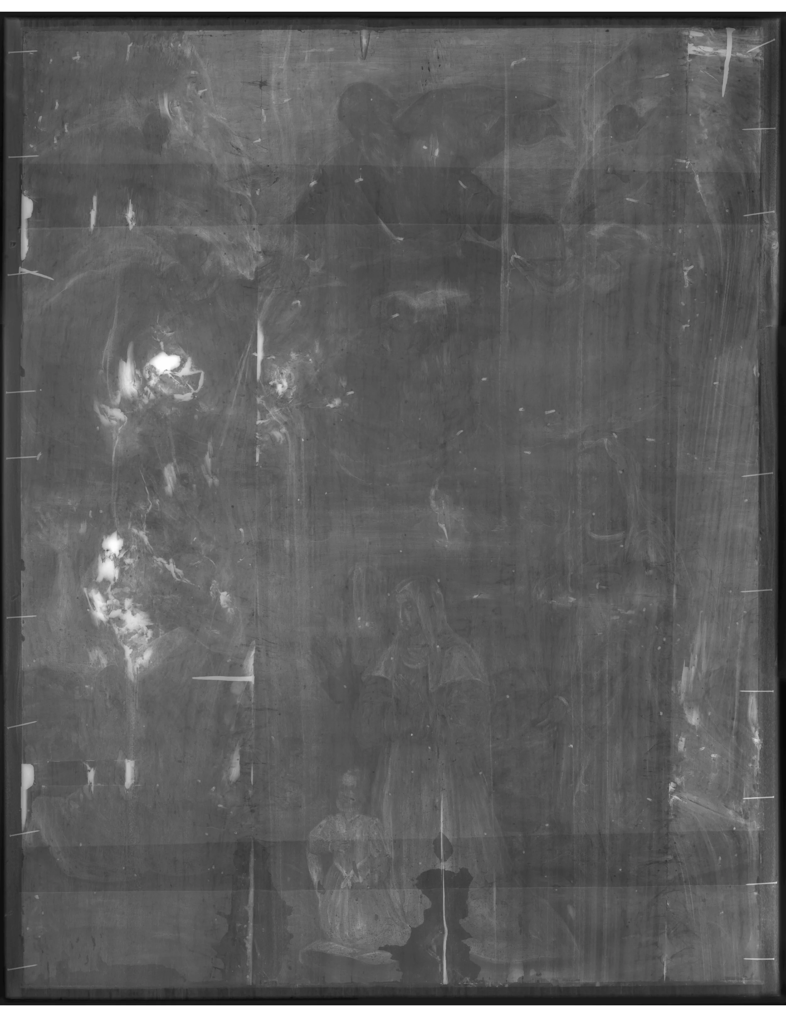 Black and white X-radiograph of the present work.