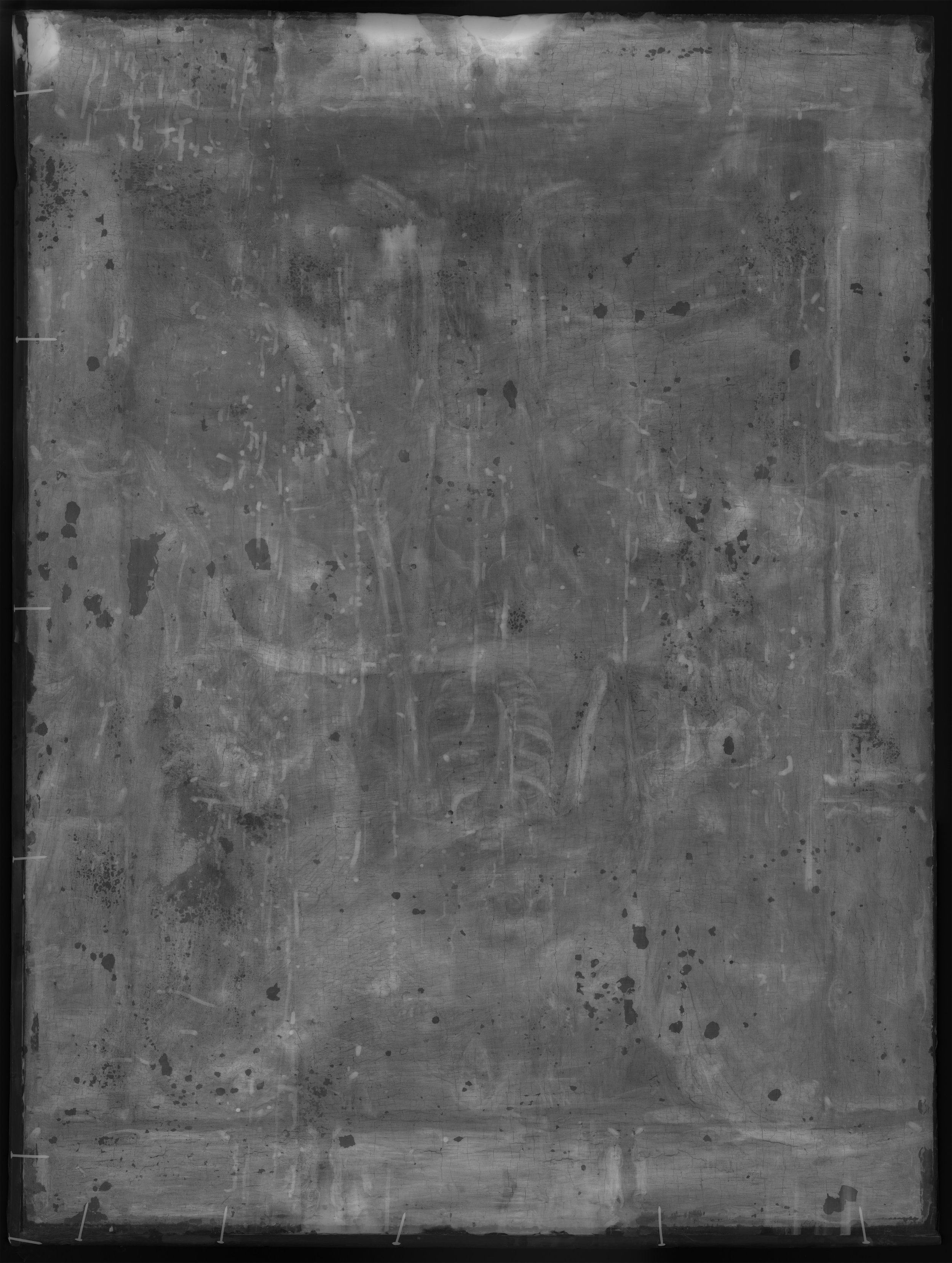 Black and white X-radiograph of the present work.