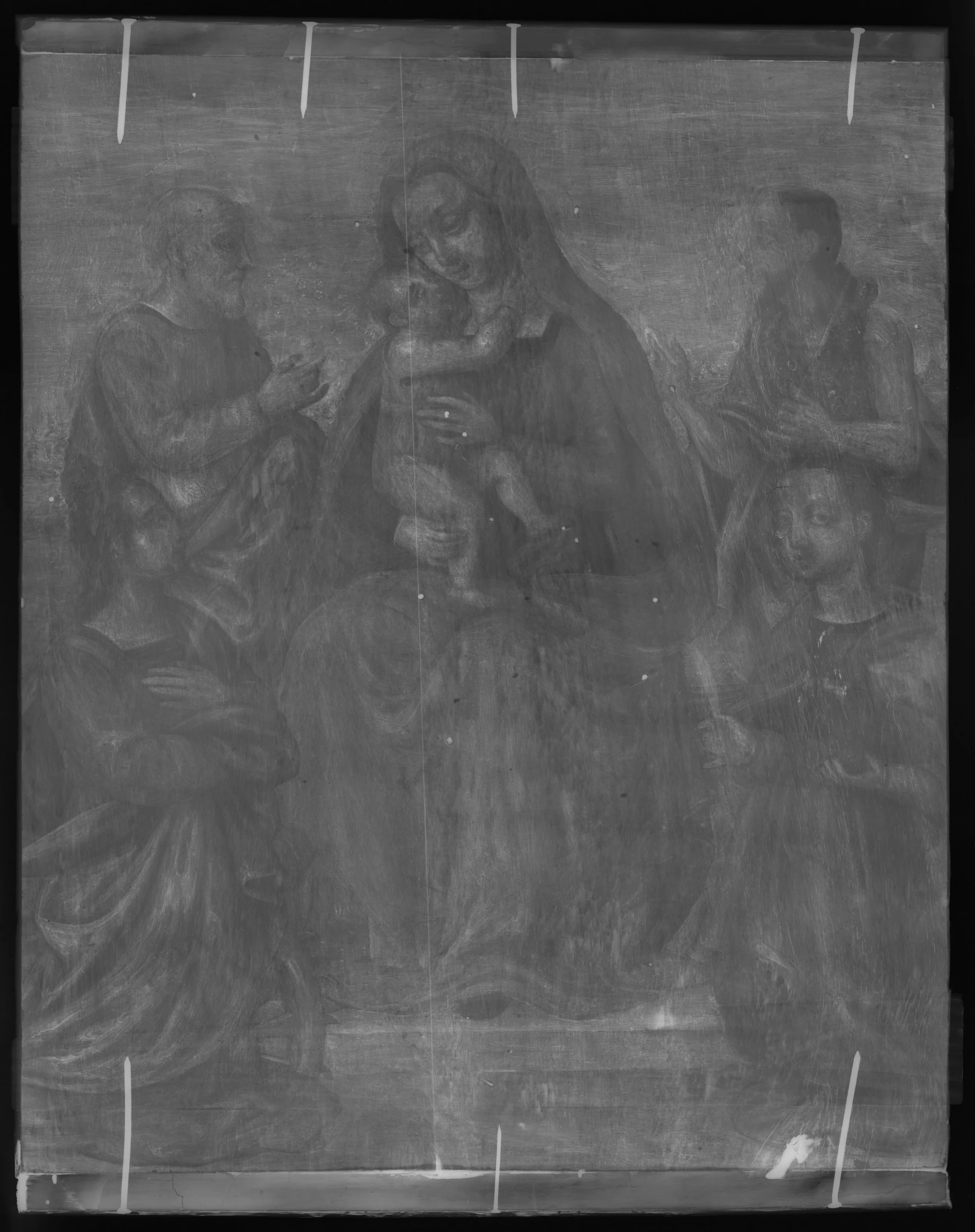 Black and white X-radiograph of the present work.