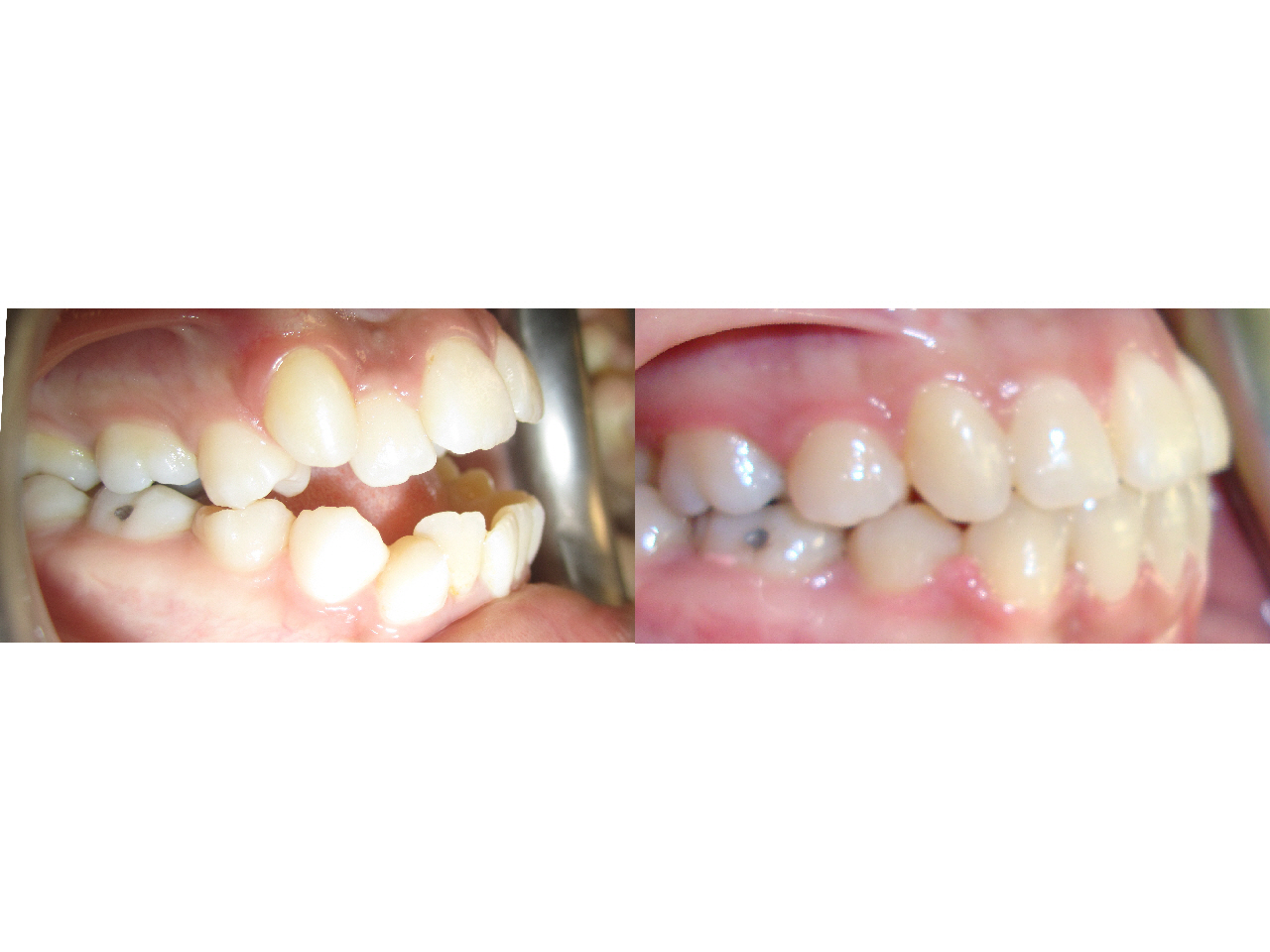 Before/After