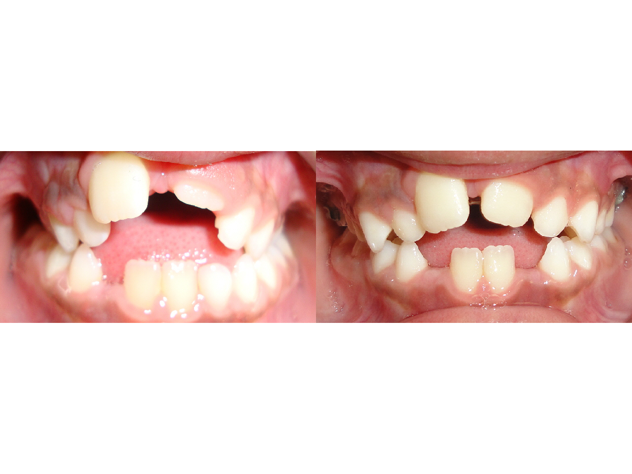 Before/After Expander