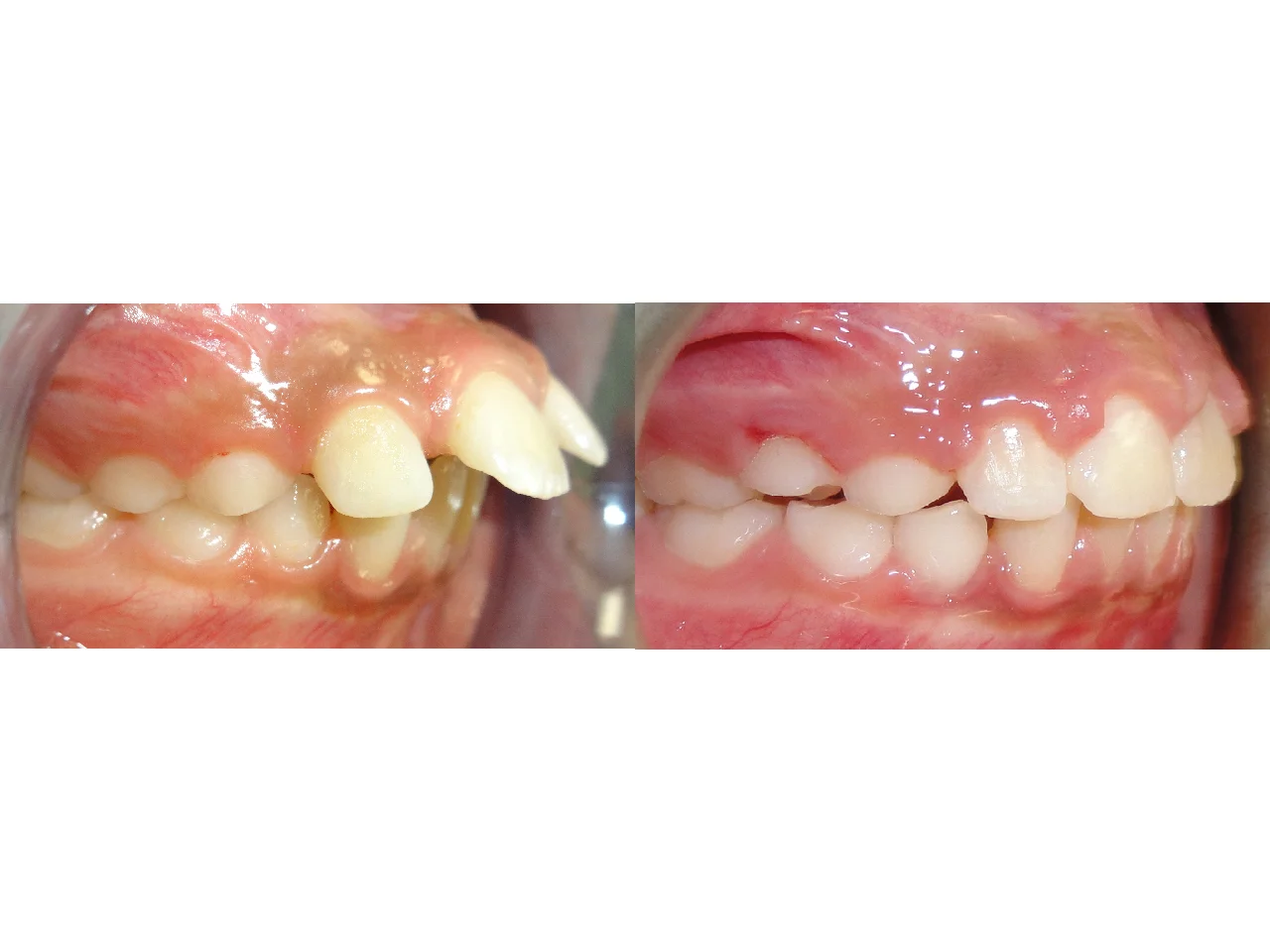 Before/After