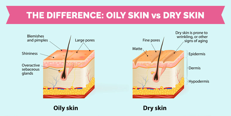 oily-skin-vs-dry-skin.jpg