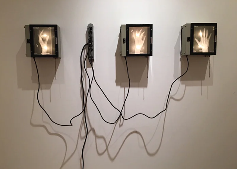 X-rays from the Inflamed Knuckle series