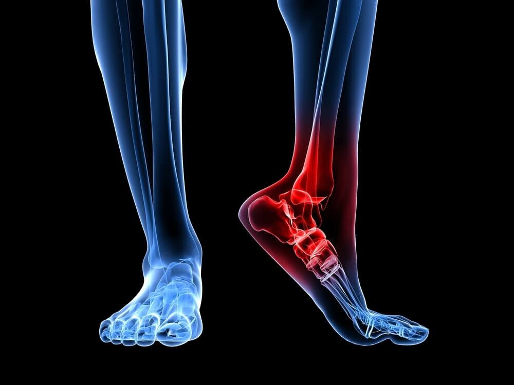 ankle injury talus fracture treatment gaithersburg maryland