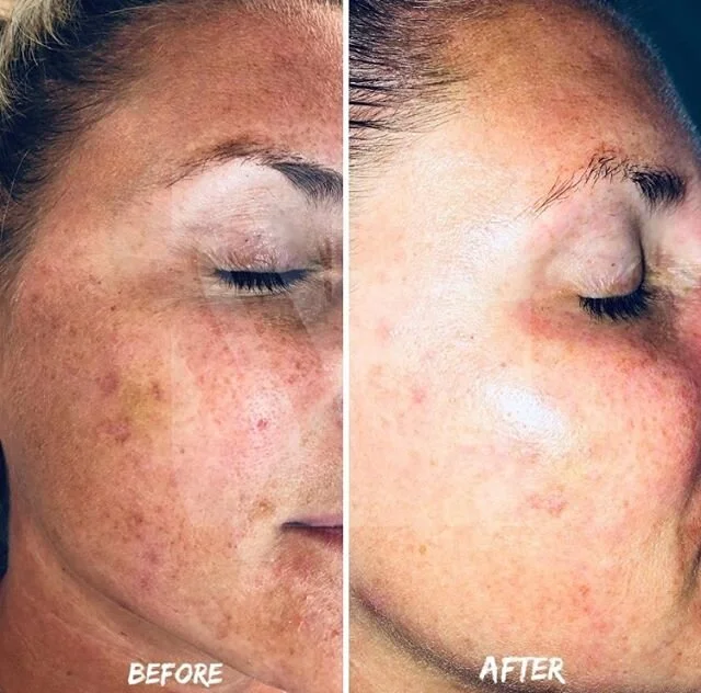 Studio Skin Medical Esthetics Regina Hydra Facial IPL & Laser Regina Botox Regina Eyelash