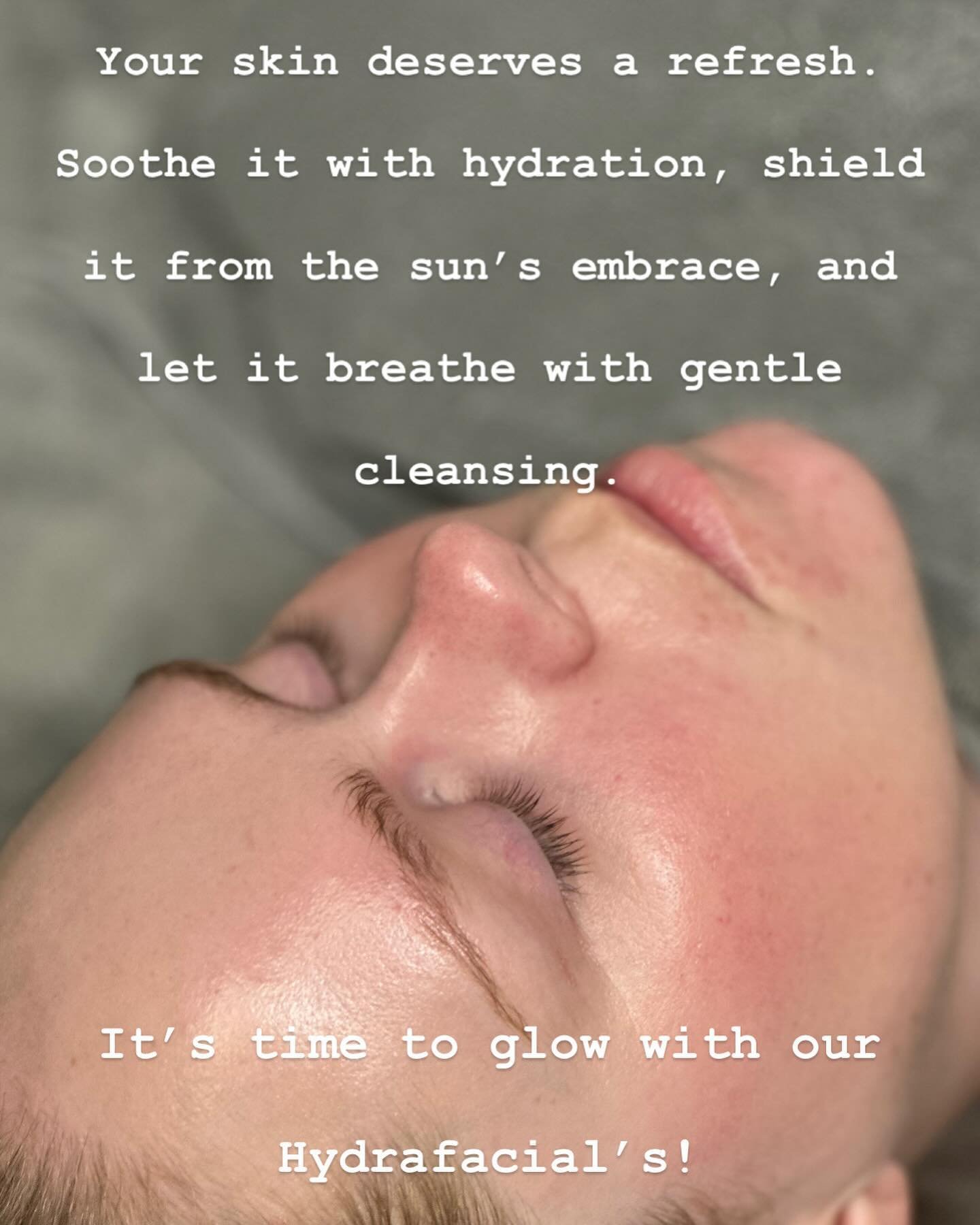 It&rsquo;s time for your skin&rsquo;s refresh! 
Get your spot booked for a HydraFacial today! 
🔗 in bio. 

#studioskinregina #yqrhydrafacial  #skinneeds #getyourglowon #deepclean #freshface #yqrskin #skincare #skincareroutines #booktoday #glowingski